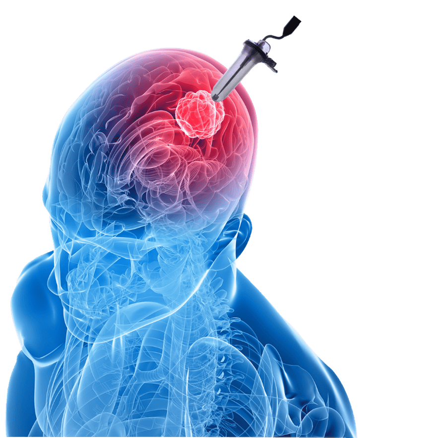 Brain Access System VBAS