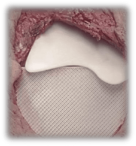 BLOOCELL DECK 2024 - 27.01 Kopie-page24-image10